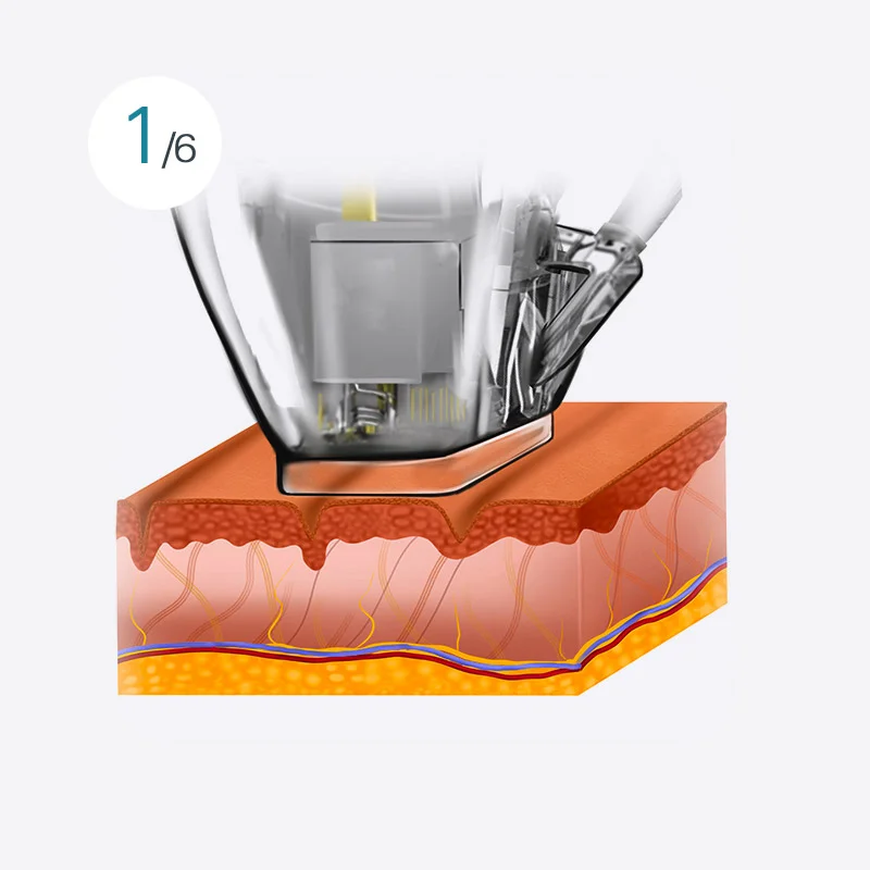 Smart Double Shot Image 1