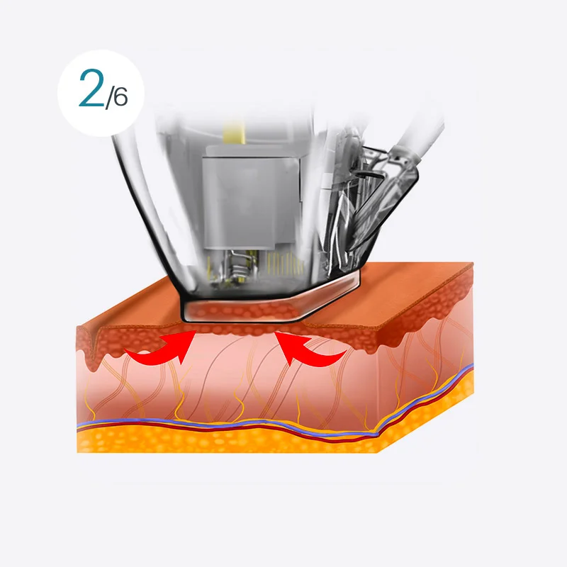 Smart Double Shot Image 2