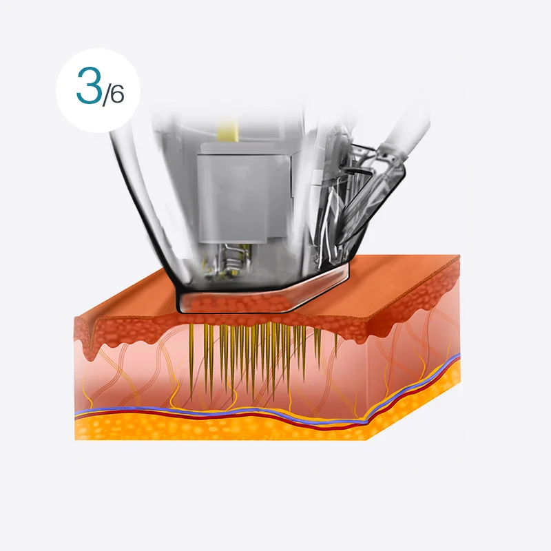 Smart Double Shot Image 3