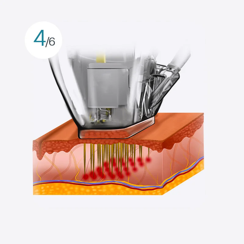 Smart Double Shot Image 4