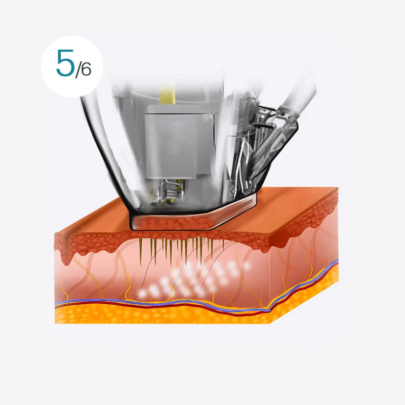 Smart Double Shot Image 5