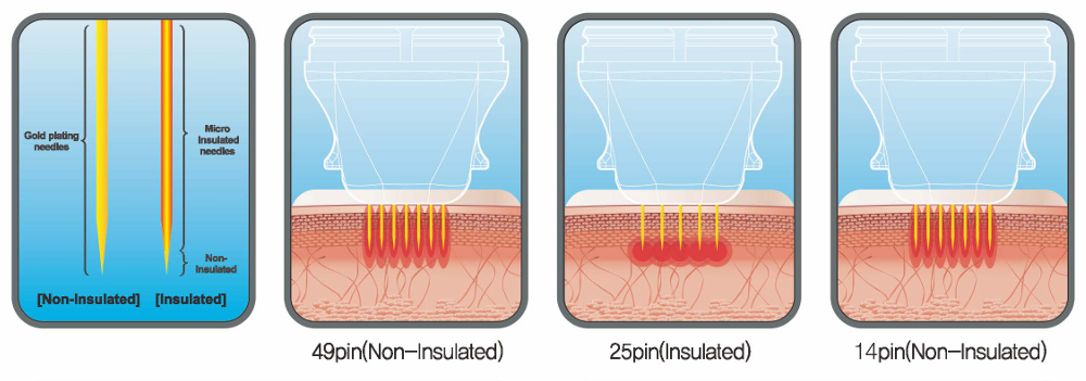 Different types of needles
